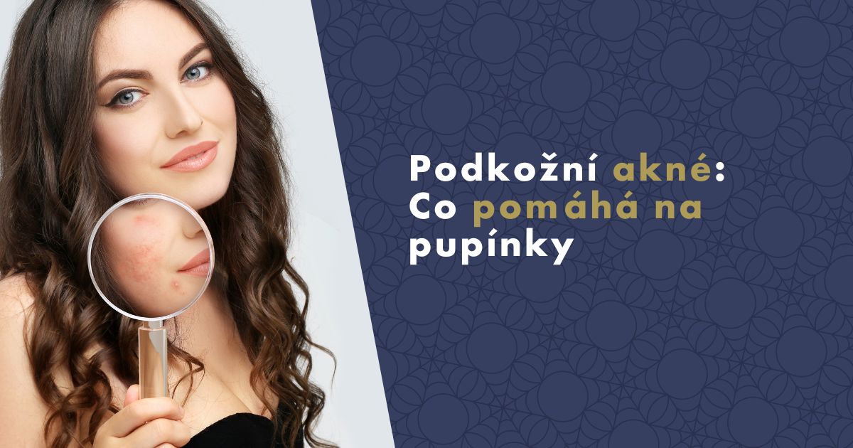 podkozni-akne-co-pomaha-na-pupinky-fb